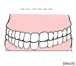Bild anzeigen Zähne - Rechtschreibübung